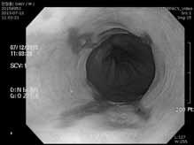 역류성식도염의진단및치료 / 박영규 Management of GERD - 최신임상진료지침중심으로 - Treatment Treatment (1): lifestyle