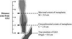 2013 대한임상건강증진학회추계합동학술대회 Barrett s Esophagus Length of Barrett s Esophagus Prague Criteria SCJ SCJ Goblet cell C2M5 GEJ SCJ metaplasia Normal CLE BE Gastoenterology 2006;131:1392 1399 Biopsy of