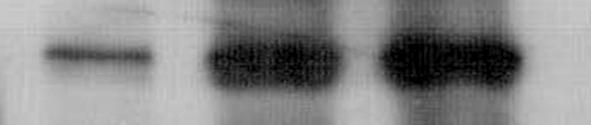 AH Kim et al: The effect of particulate matter 10 to MRC-5 fibroblast cells Figure 3. TGF-ß in MRC-5 cells after 24 hours incubation with PM 10. TGF-ß was detected by western blotting.