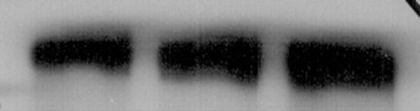 Tuberculosis and Respiratory Diseases Vol. 67. No. 6, Dec. 2009 Figure 6. Fibronectin and β-actin in MRC-5 cells after 24 hours incubation with PM 10.