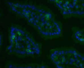 16) 그러나호흡기, 특히인체호흡기내에상재하고있는 resident γδ T 세포에대한연구는매우미흡한수준이며현재세계적으로진행되고있는연구역시하부호흡기인폐에만국한되어있다. 1988년 Charles Janeway에의해 γδ T 세포의 TCR 은 metabolically stressed epithelial 세포를인식하고제거하는기능을담당할것이라는가설이제안되었다.