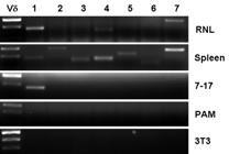 Regulation of skin cell homeostasis by gamma delta T cells. Front Biosci 2004;9: 2640-51. 4) Boismenu R, Havran WL. Modulation of epithelial cell growth by intraepithelial gamma delta T cells.