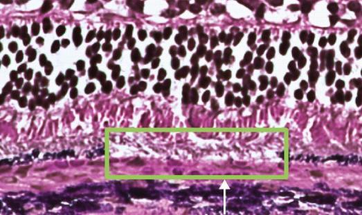 (FOVEA) 조사가능 자동제어기술통한안전성확보 출처 1 : Roider, Brinkmann.