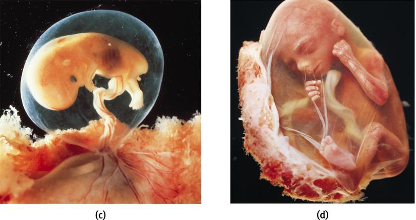 태아기 (fetus) 임신 9 주부터출생시까지발달하는뱃속유기체 Lennart Nilsson/ Albert Bonniers