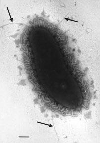 서론 19 Fig. 3. Electron micrograph of Vibrio vulnificus. * The arrows mark fimbriae (pili) of the bacterium. V. vulnificus는구강으로섭취되어위장관에서직접혈류로들어가패혈증을일으키며, 혈중에일정농도이상으로증식하였을경우다시조직에침착되어괴저를일으키는병의경과를보인다.