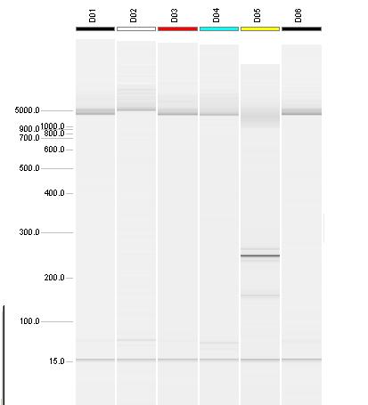 바이러스검사결과 : 노로바이러스불검출 PCR 전기영동사진첨부 G1 (+) (-) G2 (-) (+) (-) Lane1 M지점 ( 직수 ) 음성 Lane1 M지점 ( 직수 ) 음성 Lane2 M지점 ( 직수 )( 반복 ) 음성 Lane2 M지점 ( 직수 )( 반복 ) 음성 Lane3 C 동앞옥외수도꼭지 ( 저수조, 물탱크경유수 ) 음성 Lane3 C