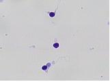 Analysis of sperm morphology using Diff- Quick staining. Eun Kyung Kim.