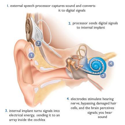 기획 2 NBT 융합기술을이용한신경기능재생소자기술 과제명 : Si-based Neurodevice 나노바이오융합기술 기존기술 : 뉴런-반도체칩을이용하여뉴런들의기능과활동을전기적으로측정하고응용하는연구가진행되고있으나 Si 뉴런연구는아직까지개념정립단계 혁신적신기술