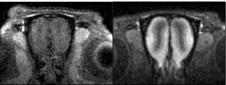 기획 19 살아있는후각신경세포의 MRI 영상기술 과제명 : 후각신경세포와세포망의기능적영상화 기존기술 : 기존영상기술로는후각신경의이미지를정확히얻는것이불가능함 혁신적신기술 : 나노입자조형제를새로이개발, 이용하여살아있는후각신경및기타영상을얻기힘들었던신경세포의이미지를획득하는기술 기획대상기술의개요 생체친화적나노입자를후각신경세포 MRI 조영제로개발하고, 이를고해상도