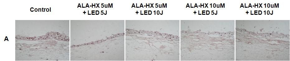 cells and its PDT effect.