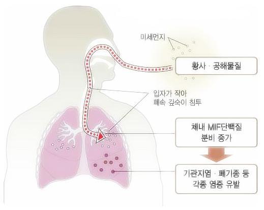 PM2.5 농도상승은 사망률과각종질병 발생확률높여 PM2.5 는 PM1에비해질병발생위험이더높고, 노약자에대한위험성도증가한다. 연구결과에따르면 PM2.