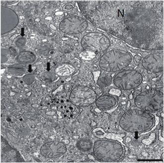 TEM(Transmission Electron 