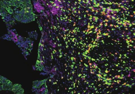 15 Human Tissue 에서 Immune