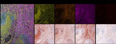 Tissue 에서 Immune Profiling