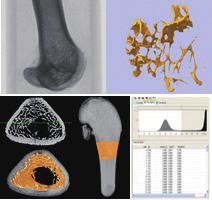 4T MRI / 7T MRI 종양, 뇌질환, 뇌기능, 심혈관질환에대한신약후보물질평가, 염증, 대사물질,