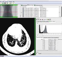 뇌기능영상 뇌질환평가 종양평가 마이크로컴퓨터단층촬영 (Micro-CT) _ In vivo micro CT /