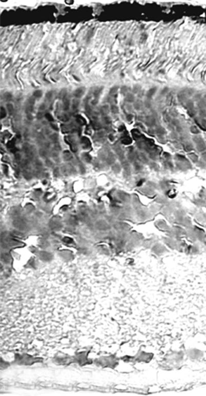 - 안상일 외 : 망막변성 생쥐에서 F4/80와 nestin의 발현 - 결 용체층(photoreceptor layer)과 외핵층(outer nuclear lay- 과 er)의 배열이