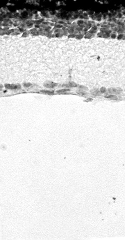 MNU 주입 2일 후엔 으며 외핵층은 1-2층만이 남아있고 내핵층(inner nuclear 대조군과 비교하여 망막의 두께가 다소 감소하였으며 광수 layer) 또한 얇아졌다.