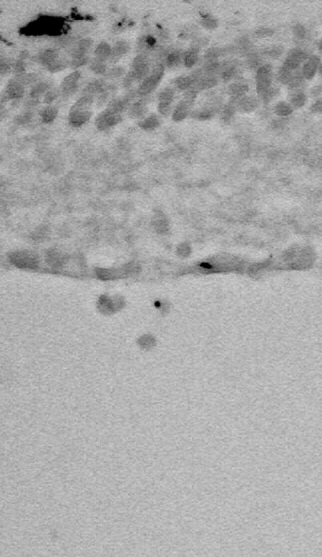 photoreceptor layer; ONL = outer nuclear layer; OPL = outer plexiform layer; INL = inner nuclear layer;