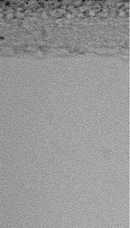 A B C MNU 2 days MNU 7 days D 20 µm Control MNU 30 days Figure 2. TUNEL staining results of the retina.