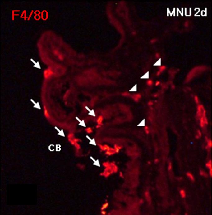 MNU 주입 7일째 시신경에서는 F4/80 또 terisks) F4/80 및 nestin을 함께 발현하는 세포는 관찰되 는 nestin을 발현하는 세포들이