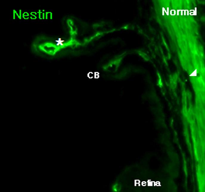 발현하는 세포들이 다수 관찰 발현되고 있으나 nestin은 함께 발현하지 않았다(Fig. 되었고 이들은 F4/80 및 nestin을 함께 발현하였다(Fig.