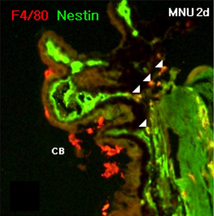 The stroma of ciliary body is non-specifically stained by nestin, but F4/80 is not