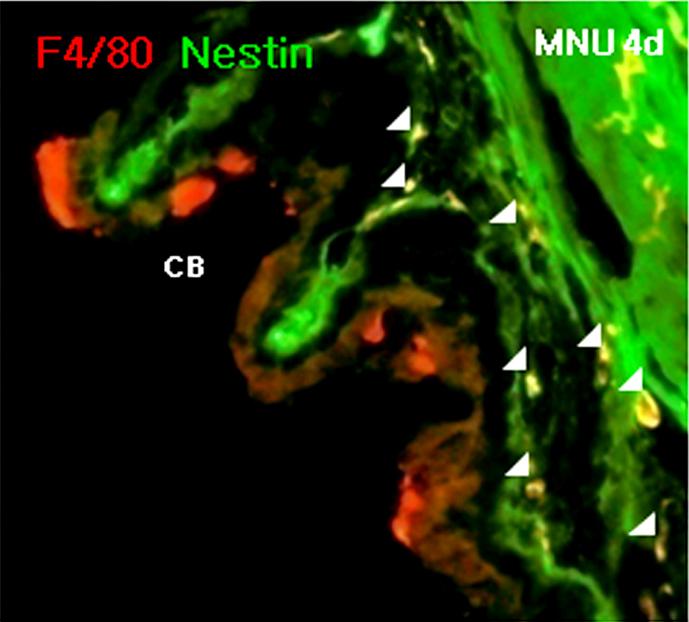 In the choroid, F4/80 and nestin co-expressing cells are observed (A-C: arrowhead).