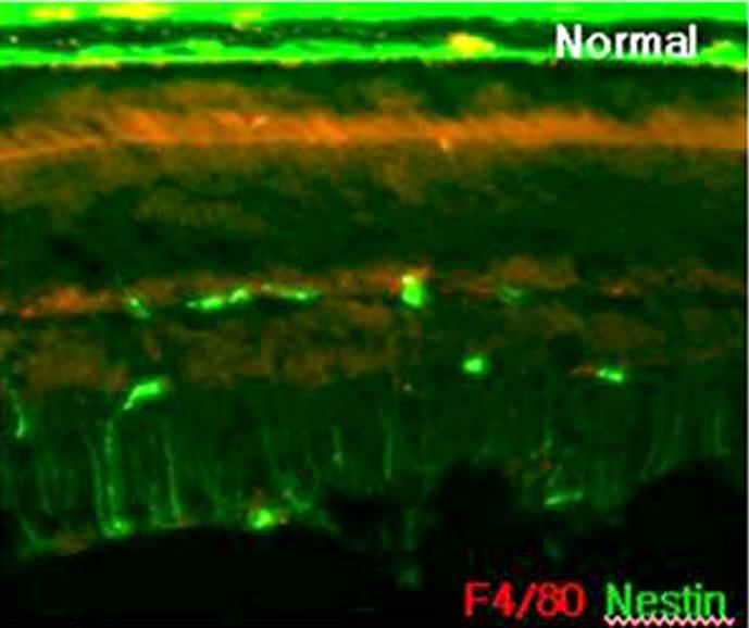 Nestin immunoactivity of the muller cells was increased (E, H) (PRL = photoreceptor layer; ONL = outer