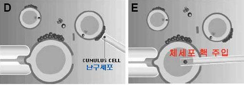 난자속으로핵이유입될가능성은희박해보입니다. 아래뉴스의후반부에서난자핵압출장면을동영상으로확인할수있습니다.