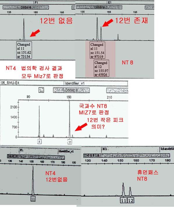 왜냐하면만약난구세포삽입에성공했다면이당시난자안에는 { 원래있던난자핵(n) + 극체의핵(n)+ 새로주입 된체세포핵(2n)} 이같이들어있어 4n 상태였을것이기때문입니다. (4) 결론: 서조위의 " 제1 극체유입에의한단성생식" 이가능하려면 { 극체제거실패 + 난자핵제거실패 + 우연히 극체유입 우낮습니다.