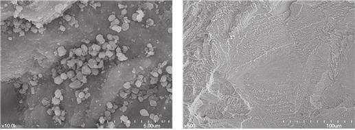 fracture surface. 로재현하여보철물을설계한다음컴퓨터에연결된절삭가공장비로보철물을제작하는방법이다. CAD를이용한보철물제작방법이처음에는삭제법인 CNC (computer numerical control) 기법이이용되었는데, CAD로디자인한정보를이용하여블럭형태의소재를삭제하여원하는최종보철물을제작한다.