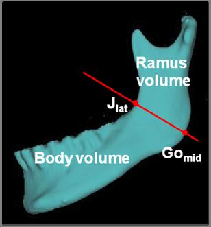 (1)하악체 길이(body length) : Gomid-Me (2)하악지 길이(ramus height) : Consup-Gomid (3)하악과두