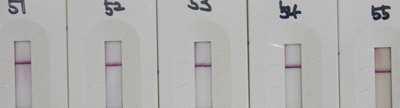 25 mg/ml 17B-MBP로대체한것도 40% 의민감도를나타내었으나 17B-MBP를 test line과 gold conjugate로동시에사용한