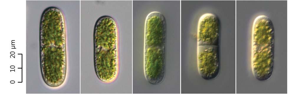 10 (Algae) ( I) : 16 (Guiry and Guiry 2012), 5. :,,. : West and G.S. West (1904), Huber-Pestalozzi (1982), Coesel and Meesters (2007). 1. Cylindrocystis brebissonii (Ralfs) de Bary 1858: 35, 74 ( 1, 2).