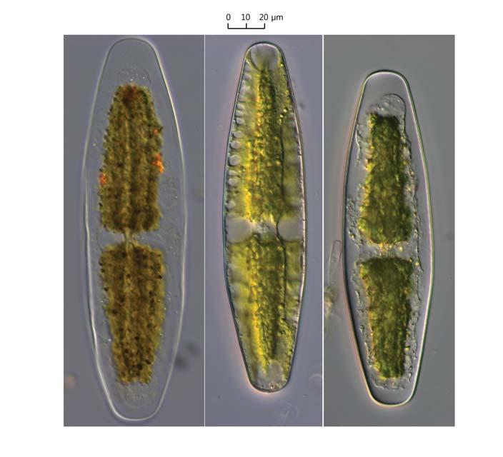 12 (Algae) ( I) 2. Netrium digitus (Brébisson ex Ralfs) Itzigsohn et Rothe 1856: No 508 ( 3, 4). West and G.S. West 1904: 64. pl. 6. f. 14 16. Huber- Pestalozzi 1982: 34. pl. 1. f. 7.