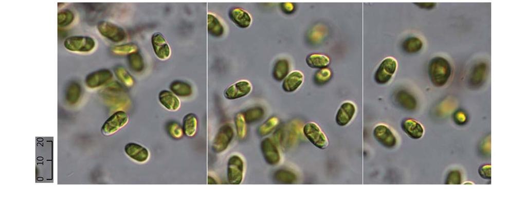 20 (Algae) ( I) : ( ; 18.viii.2010, ; 26.v. 2011). :, 7 12. 12. Spirotaenia condensata. 7. Spirotaenia endospira W. Archer 1864: 39 ( 13, 14). West and G.S. West 1904: 39.