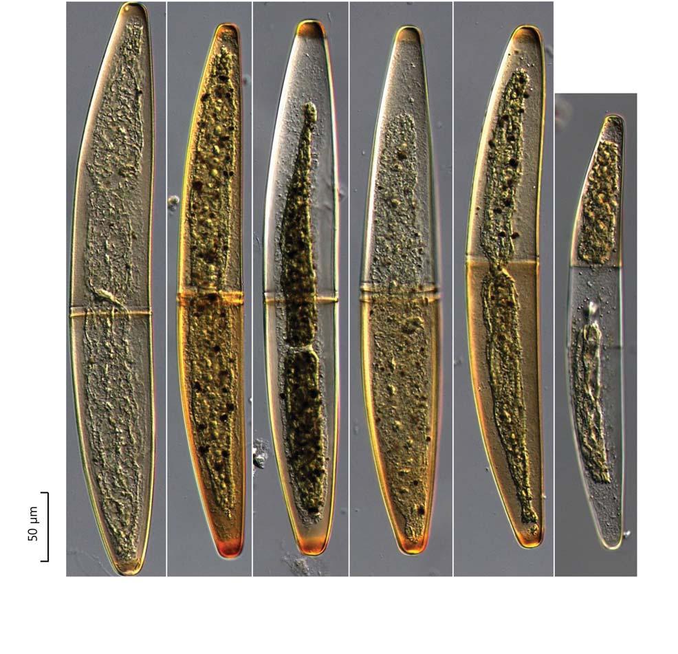 42 (Algae) ( I) 50 A B C D E F 36. Closterium baillyanum. :.