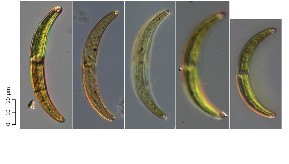 : : 43 18. Closterium cynthia De Notaris 1867: 65 ( 37, 38). Prescott et al. 1975: 44. pl. 35. f. 3, 4, 12. Růžička 1977: 232. pl. 28. f. 18 22. Huber-Pestalozzi 1982: 74. pl. 9. f. 3 6.