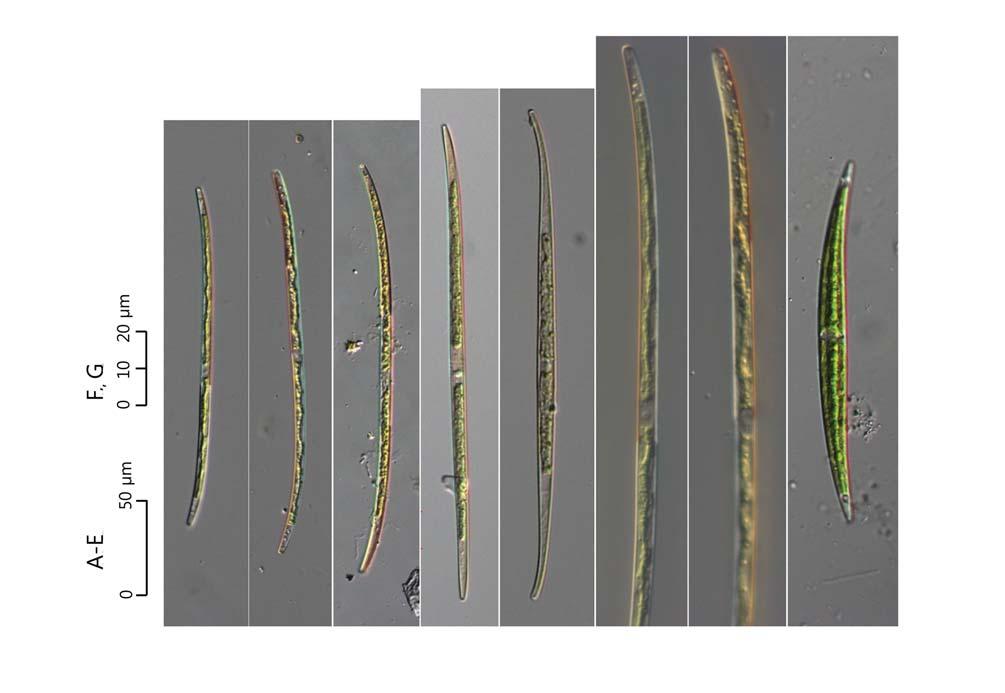 48 (Algae) ( I) 21. Closterium gracile Brébisson ex Ralfs 1848: 221 ( 43, 44A G). West and G.S. West 1904: 166. pl. 21. f. 8 12. Prescott et al. 1975: 52. pl. 16. f. 2, 15, 16.