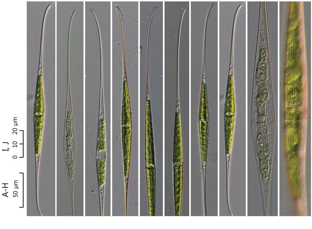 52 (Algae) ( I) 24. Closterium kuetzingii Brébisson 1856: 156 ( 49, 50). Prescott et al. 1975: 57. pl. 31. f. 6, 7, 15. Růžička 1977: 207. pl. 30. f. 9 14. Coesel and Meesters 2007: 46. pl. 17. f. 3, 4.