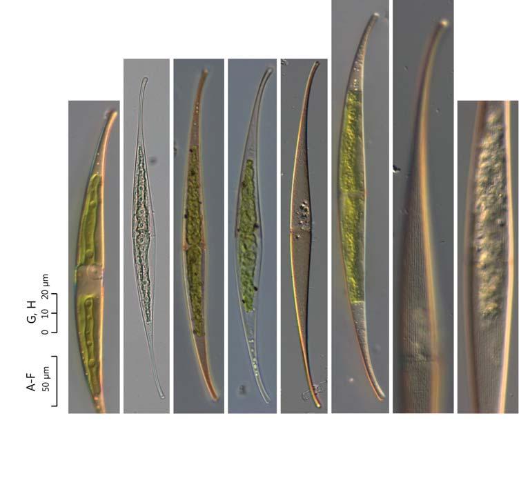 60 (Algae) ( I) : C. ralfsii,, (9 13 /10 μm). 58. Closterium ralfsii var.