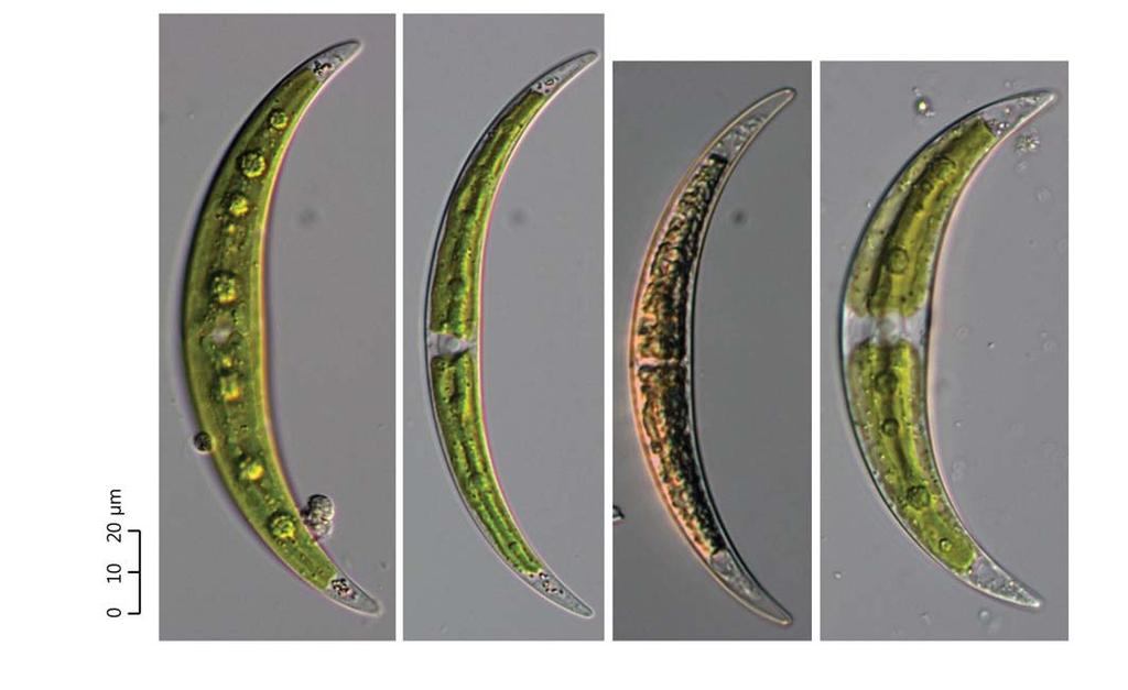 : : 65 0 10 20 A B C D 65. Closterium tumidulum., (8 10 /10 μm),.