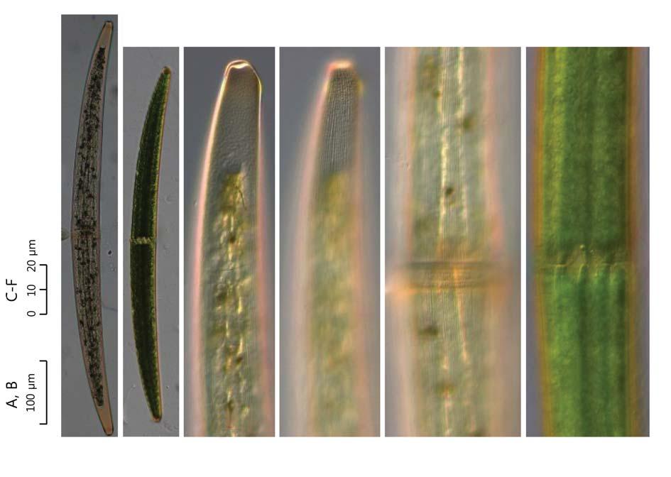 66 (Algae) ( I) A, B C F 100 0 10 20 A B C D E F 67. Closterium turgidum var. borgei. 34. Closterium venus Kützing ex Ralfs 1848: 220 ( 68, 69). West and G.S. West 1904: 137. pl. 15. f. 15 20.