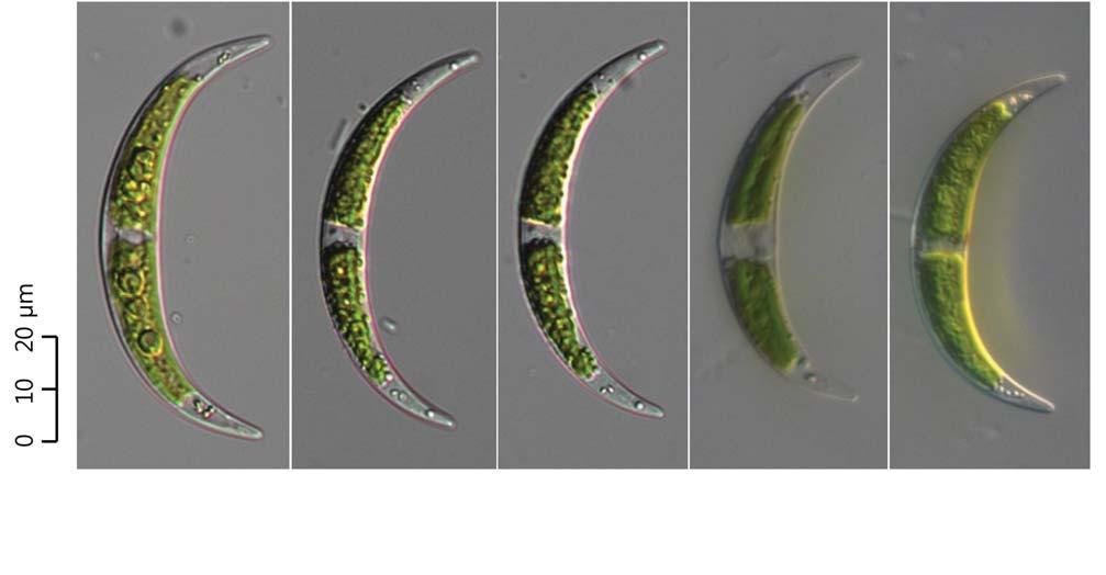 : : 67 0 10 20 A B C D E 68. Closterium venus ( 400). : ( ; 16.vii.2011).