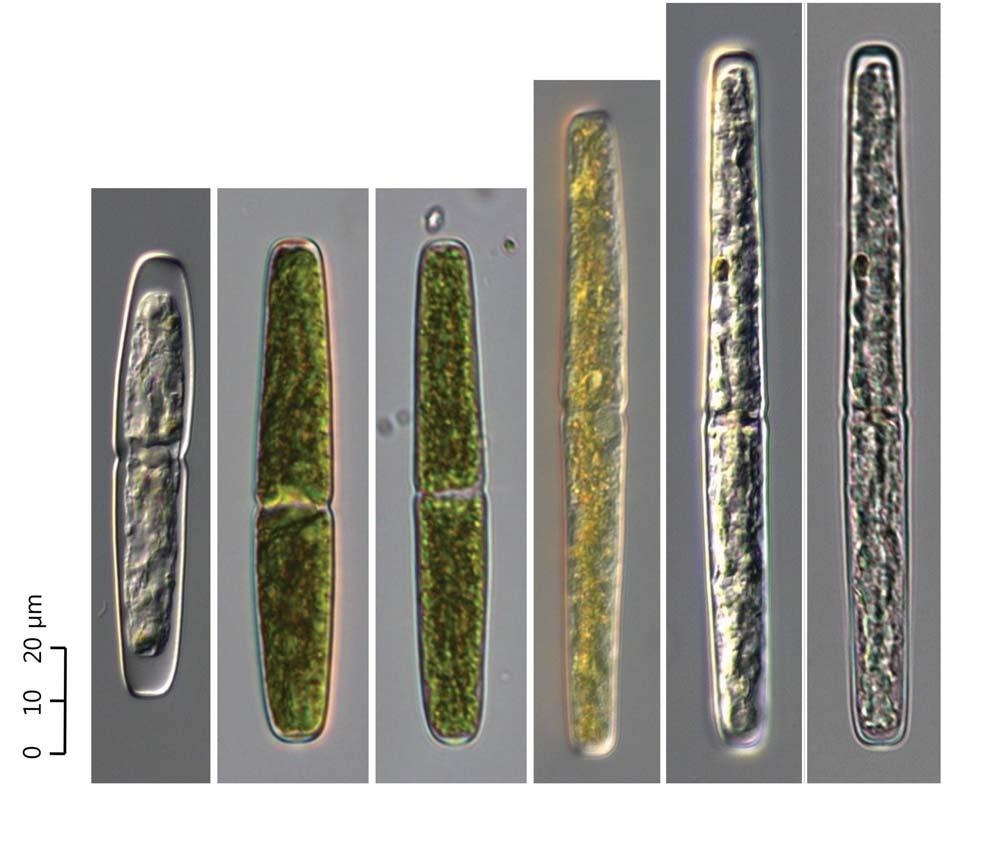 72 (Algae) ( I) 0 10 20 A B C D E F 73. Haplotaenium minutum. 37. Haplotaenium minutum var. crassum (West) Cambra 1998: 423 ( 74, 75). West and G.S. West 1904: 105. pl. 10. f. 11 13. Prescott et al.