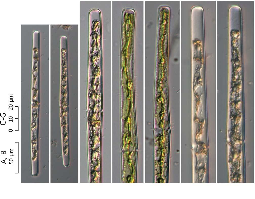 74 (Algae) ( I) 38. Haplotaenium minutum var. gracile (Wille) Bando 1988: 25 ( 76, 77). West and G.S. West 1904: 103. pl. 10. f. 6. Prescott et al. 1975: 123. pl. 39. f. 9, 10. Růžička 1977: 259. pl. 36.