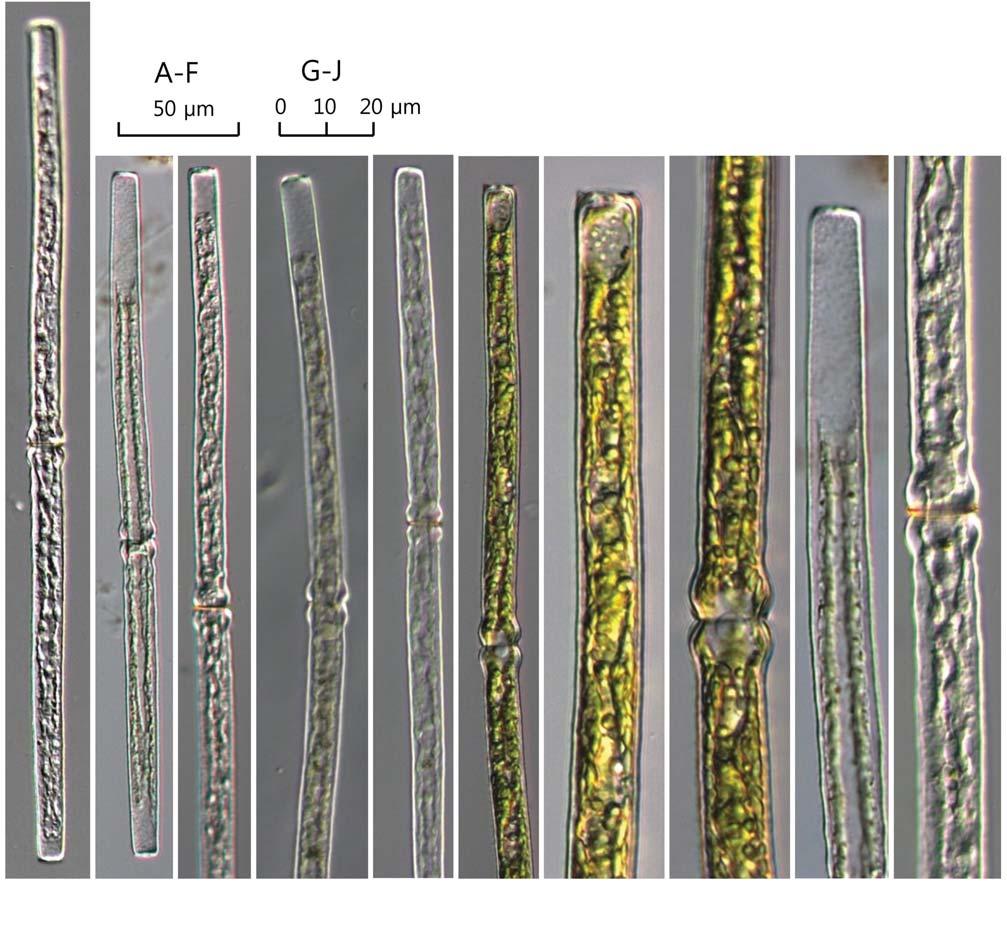 80 (Algae) ( I) 41. Pleurotaenium ehrenbergii var. elongatum (West) West 1892: 119 ( 82, 83). West and G.S. West 1904: 207. pl. 30. f. 3. Prescott et al. 1975: 117. pl. 46. f. 1 3.