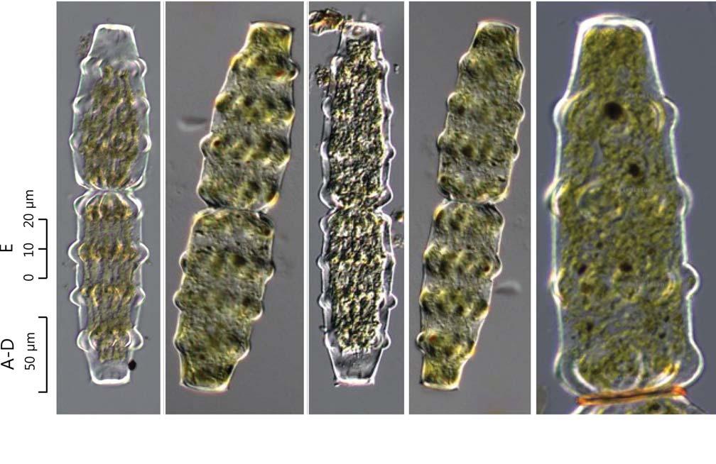 84 (Algae) ( I) 44. Pleurotaenium nodosum var. latum Irénée-Marie 1954: 81 ( 88, 89). Prescott et al. 1975: 126. pl. 44. f. 11, 4 4.5,,, 8 10, 11 14 4,.