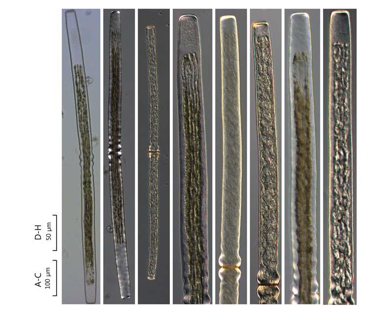 90 (Algae) ( I) 48. Pleurotaenium trabecula var. elongatum Cedergren 1913: 12 ( 96, 97). Krieger 1937: 399. pl. 40. f. 5. Prescott et al. 1975: 138. pl. 40. f. 13 16. Růžička 1977: 269. pl. 38.